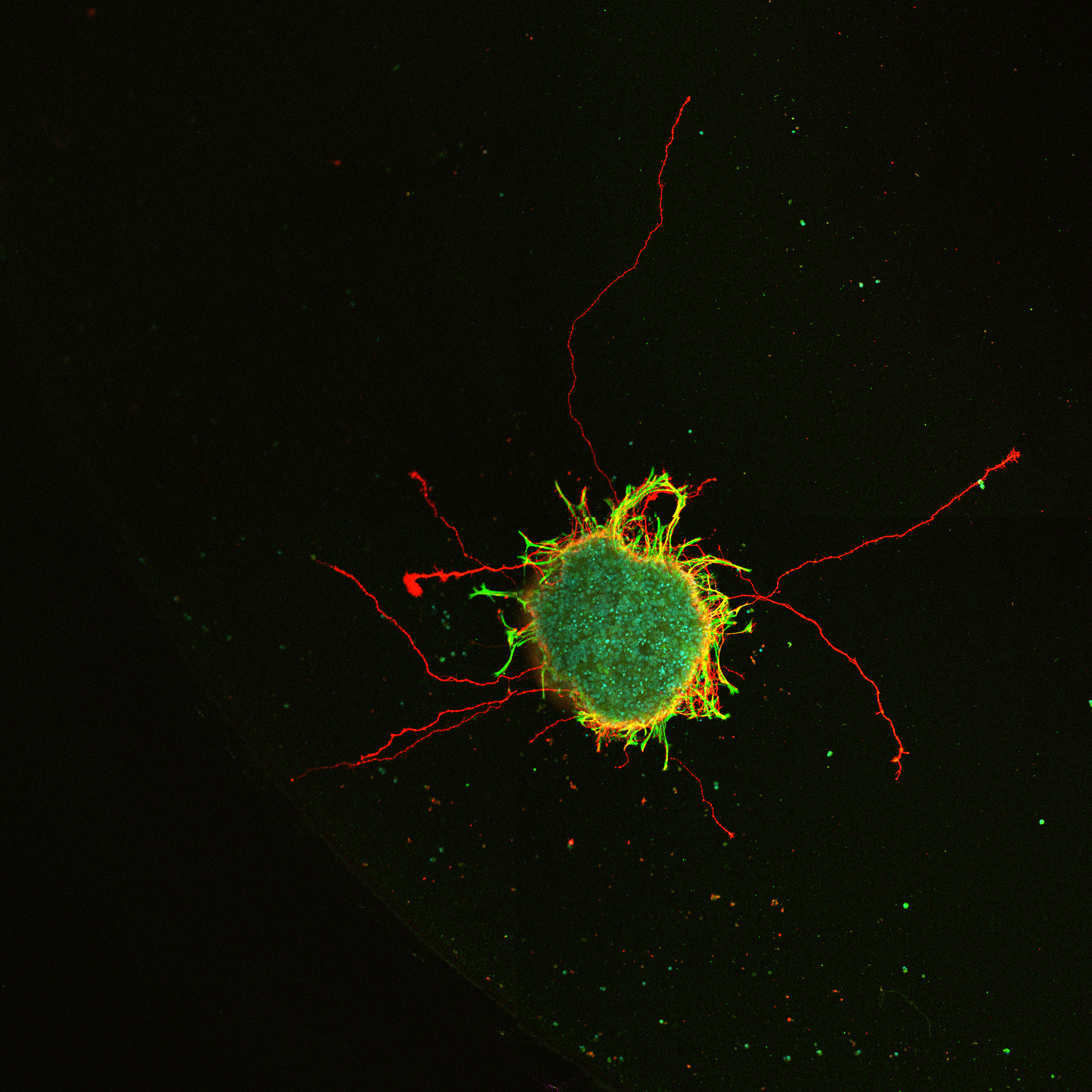 Neuroprotection Research
